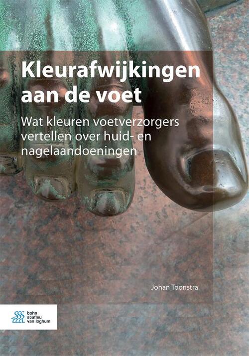 Kleurafwijkingen aan de voet - Johan Toonstra, Tineke de Beer - Paperback (9789036827324)