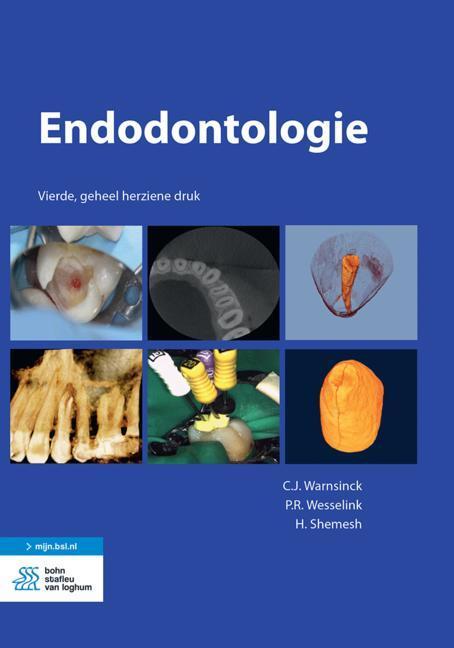 Endodontologie - Paperback (9789036827669)