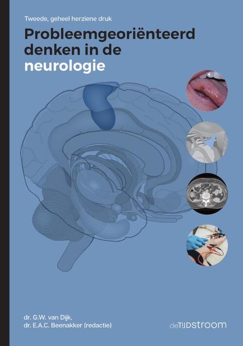 Probleemgeoriënteerd denken in de neurologie - Paperback (9789058983367)